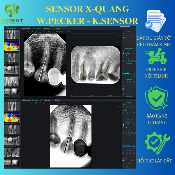 Sensor X-quang